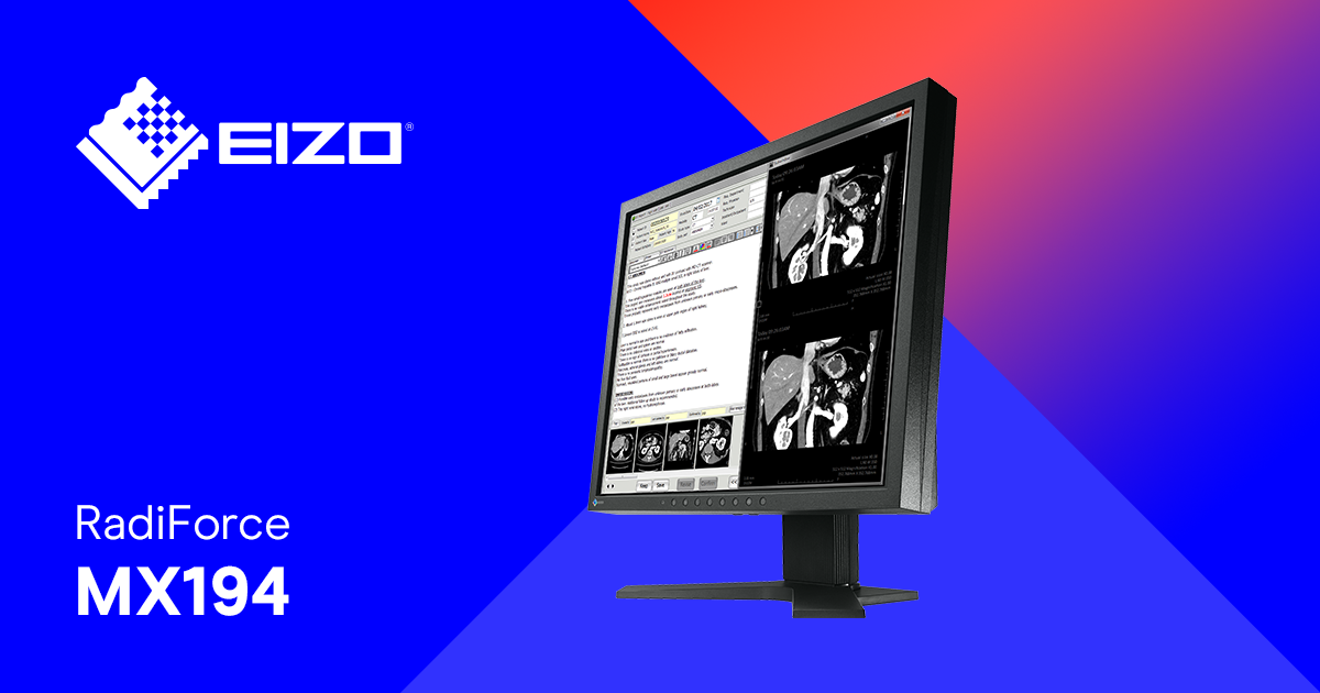 RadiForce MX194 | Monitor de visualización de 1,3 MP RadiForce MX194 | Monitor de visualización de 1,3 MP